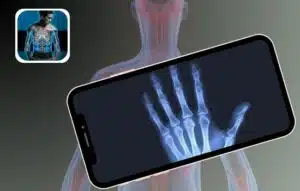 Sumérgete en una Aventura Anatómica con XRay Scanner Prank