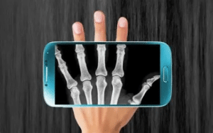 Usos Modernos y Aplicaciones de Rayos X